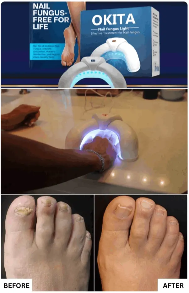 What is Okita Nail Fungus Light